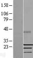 SSX2 Protein (Over-Expression Lysate Myc-DDK (Flag))