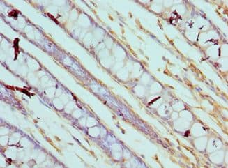 CAPN3 / Calpain 3 Antibody (aa582-821)