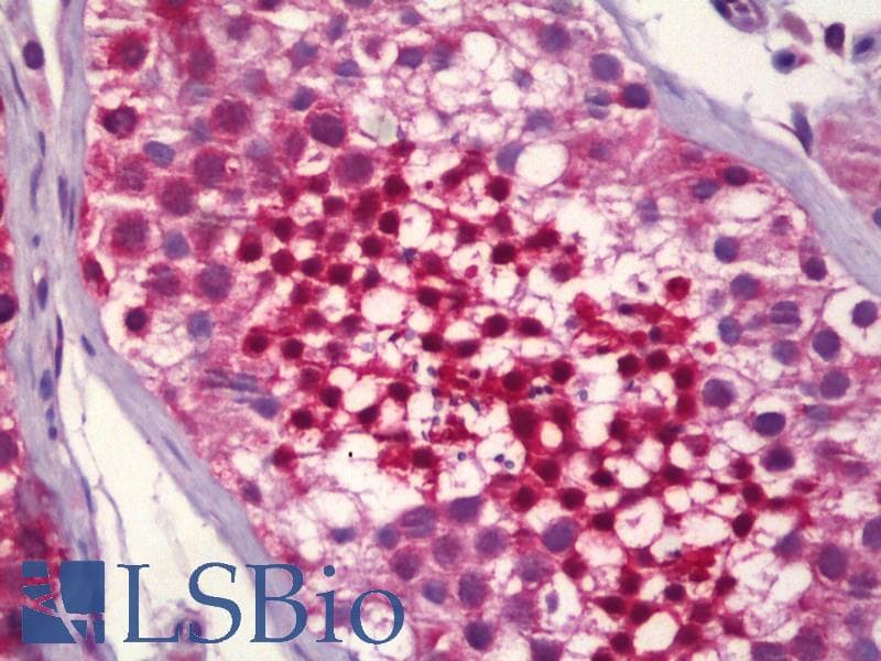 IHC-plus™ HSP70 / Heat Shock Protein 70 Antibody