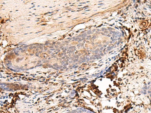 HLA-DQB1 Antibody