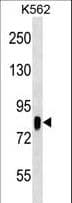 RPS6KA3 / RSK2 Antibody