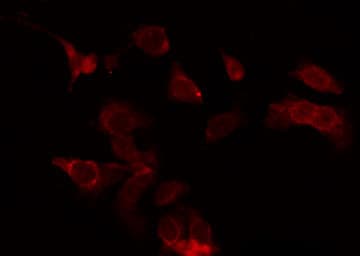 GPR49 / LGR5 Antibody