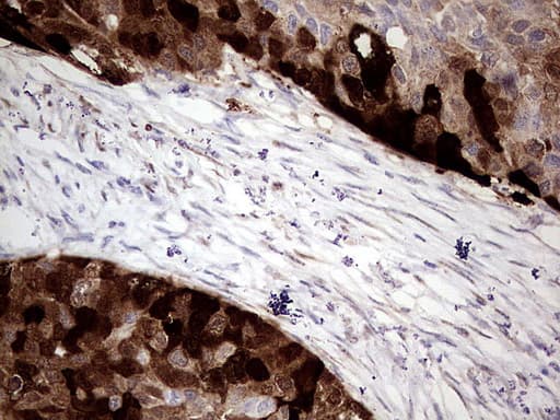 CRABP2 Antibody (clone UMAB176, Carrier-free)
