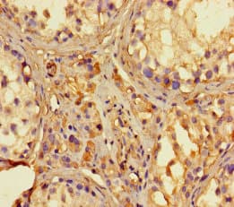Polyclonal Rabbit anti-Human RNASEL / RNase L Antibody (WB)