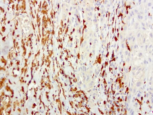 Monoclonal Mouse anti-Human S100A9 / MRP14 Antibody (clone UMAB174, IHC, WB)
