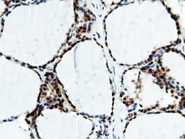 NT5DC1 Antibody (clone OTI3H2)