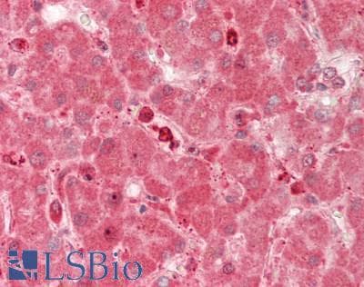 RARRES2 / Chemerin Antibody (aa33-158)