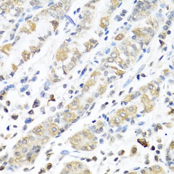 Polyclonal Rabbit anti-Human IMP-3 / IGF2BP3 Antibody (IHC, WB)