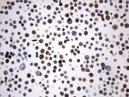 VIL1 / Villin Antibody (aa1-188, clone UMAB230)