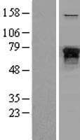 Human NF-L / NEFL Protein (Over-Expression Lysate Myc-DDK (Flag))