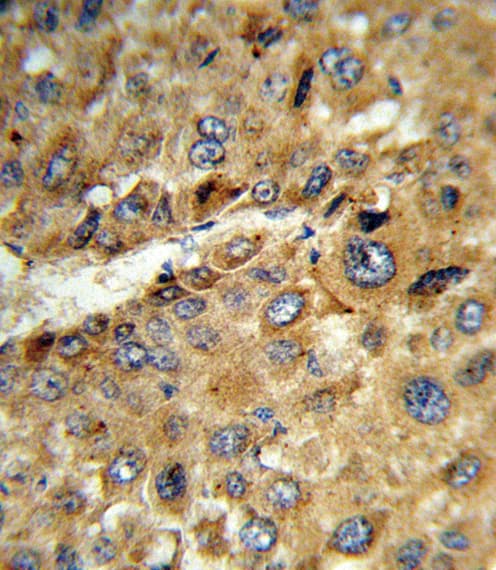 Polyclonal Rabbit anti-Human Tyrosine Aminotransferase Antibody (aa279-306, IHC, WB)