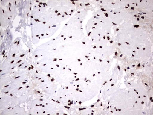 HNRPM / HNRNPM Antibody (aa1-261, clone OTI4C9)