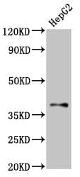 GALR1 / Galanin Receptor 1 Antibody