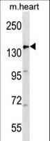 APC Antibody (aa1148-1176)