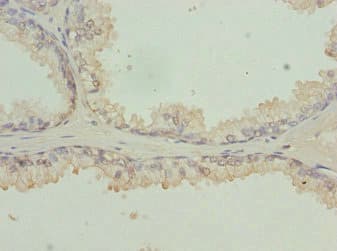 RFPL2 Antibody