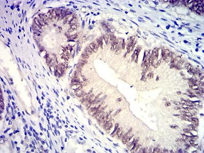 SATB2 Antibody (clone 7B2E11)