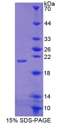 Bovine CSF3 / G-CSF Protein (Recombinant His-T7)