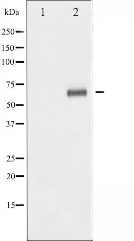 Polyclonal Rabbit anti-Human STK11 / LKB1 Antibody (phospho-Ser428, IHC, IF, WB)