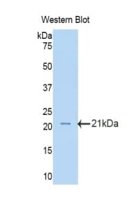 LSS Antibody (aa101-250)