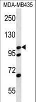CTNND2 / Delta-2 Catenin Antibody (aa1131-1159)