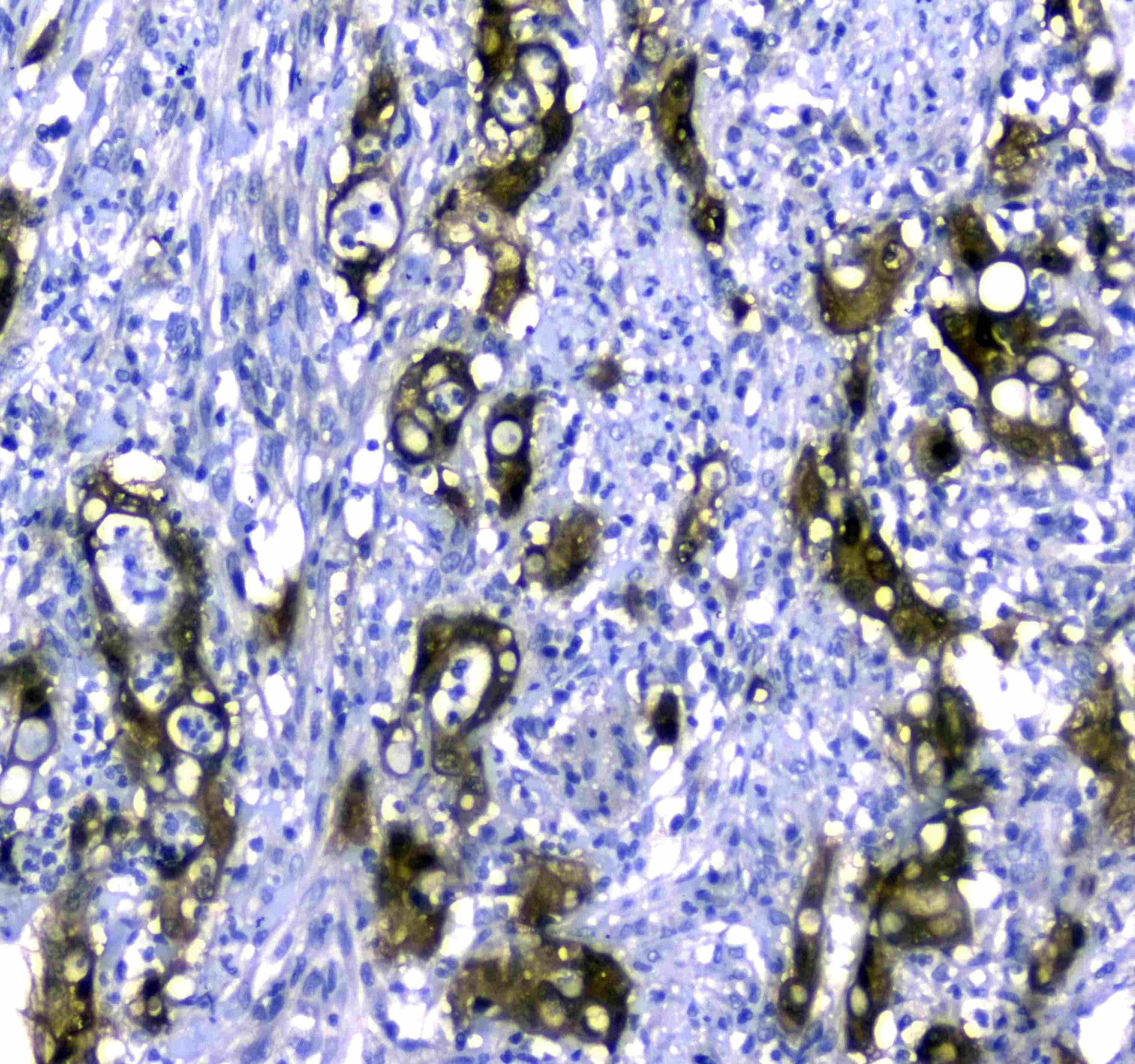 Polyclonal Rabbit anti-Human STUB1 / CHIP Antibody (IHC, WB)