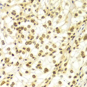LMNA / Lamin A+C Antibody