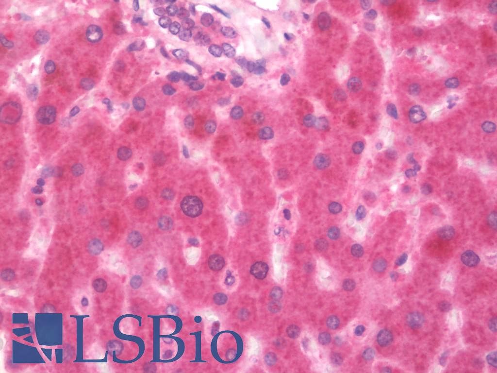 IHC-plus™ Polyclonal Rabbit anti-Human RPL36AL Antibody (IHC, WB)