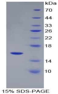 Human REN / Renin 1 Protein (Recombinant His-T7)