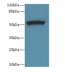 PORCN Antibody