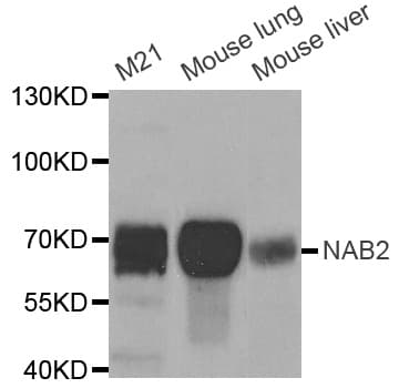 Polyclonal Rabbit anti-Human NAB2 Antibody (IHC, WB)
