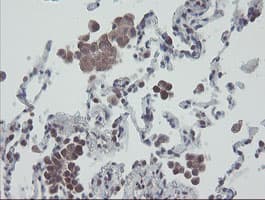 RBPMS / Hermes Antibody (clone OTI2C3, Carrier-free)