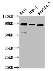 Polyclonal Rabbit anti-Human ADAM8 Antibody (IHC, IF, WB)