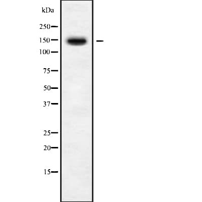 Polyclonal Rabbit anti-Human BMS1 Antibody (WB)
