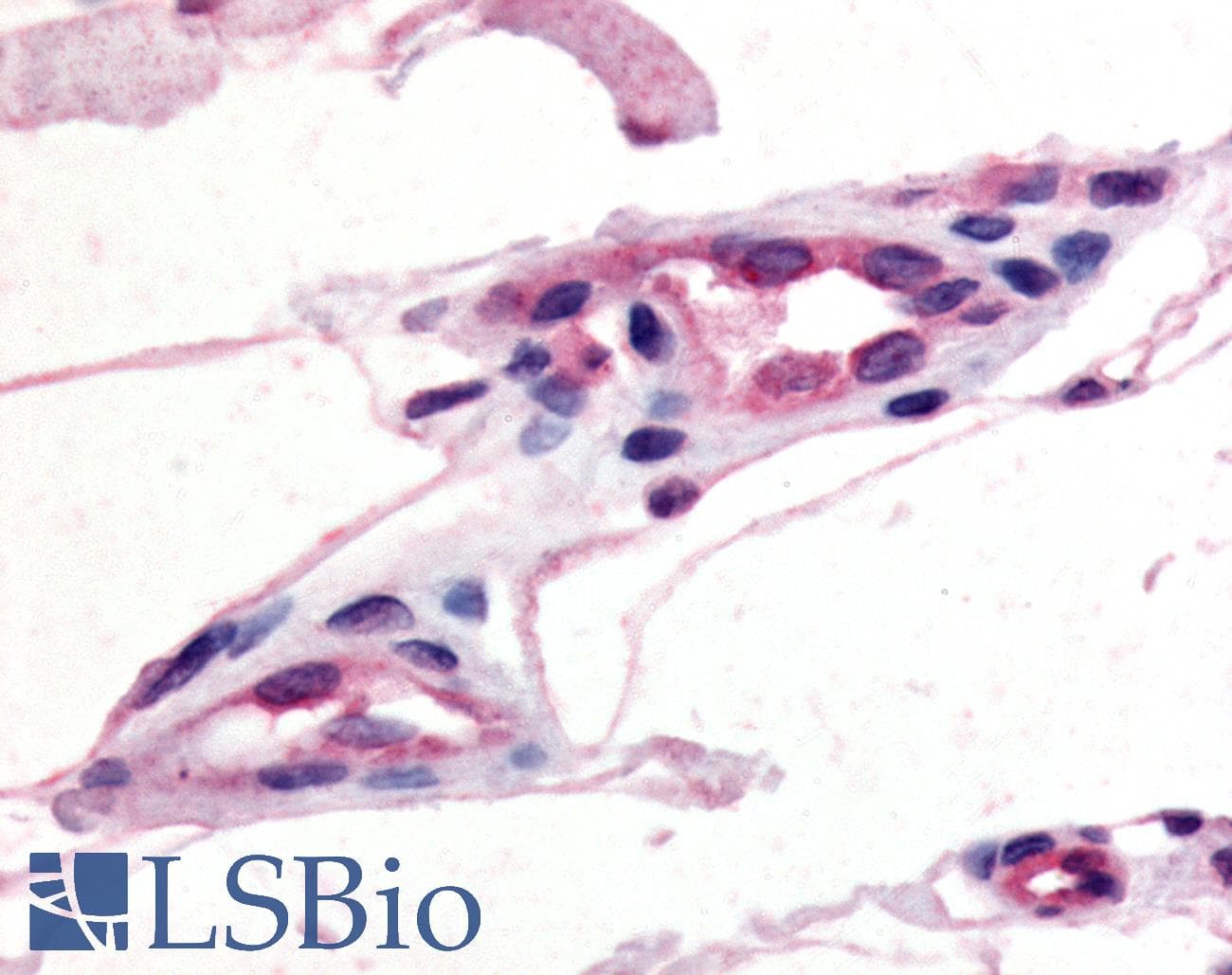IHC-plus™ Polyclonal Rabbit anti-Human CCR10 / GPR2 Antibody (C-Terminus, IHC)