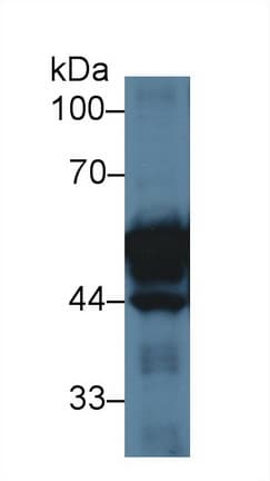 KRT20 / CK20 / Cytokeratin 20 Antibody (aa75-382)