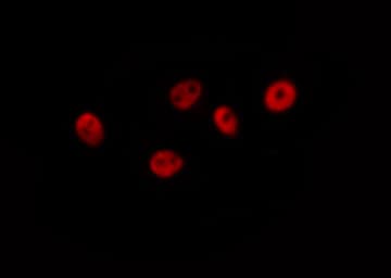 RARA / RAR Alpha Antibody (phospho-Ser77)