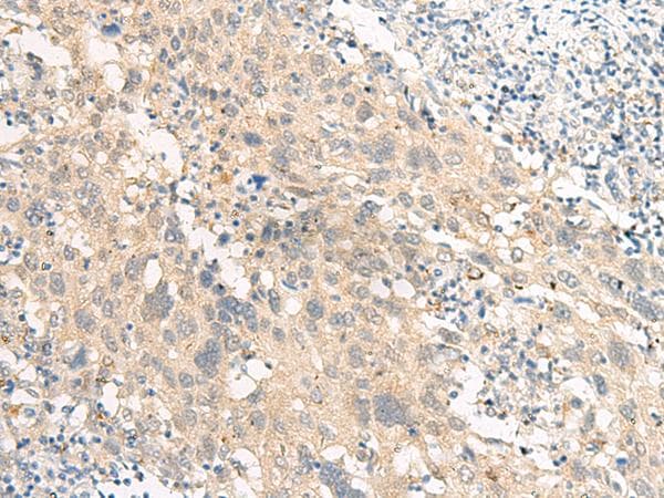 Polyclonal Rabbit anti-Human GPR22 Antibody (IHC, WB)
