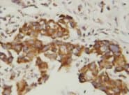 Superoxide Dismutase Antibody (aa113-129)