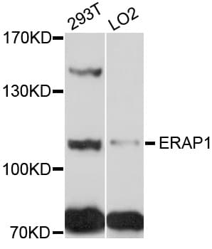 Polyclonal Rabbit anti-Human ARTS1 / ERAP1 Antibody (WB)