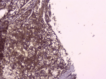 PEBP1 / RKIP Antibody