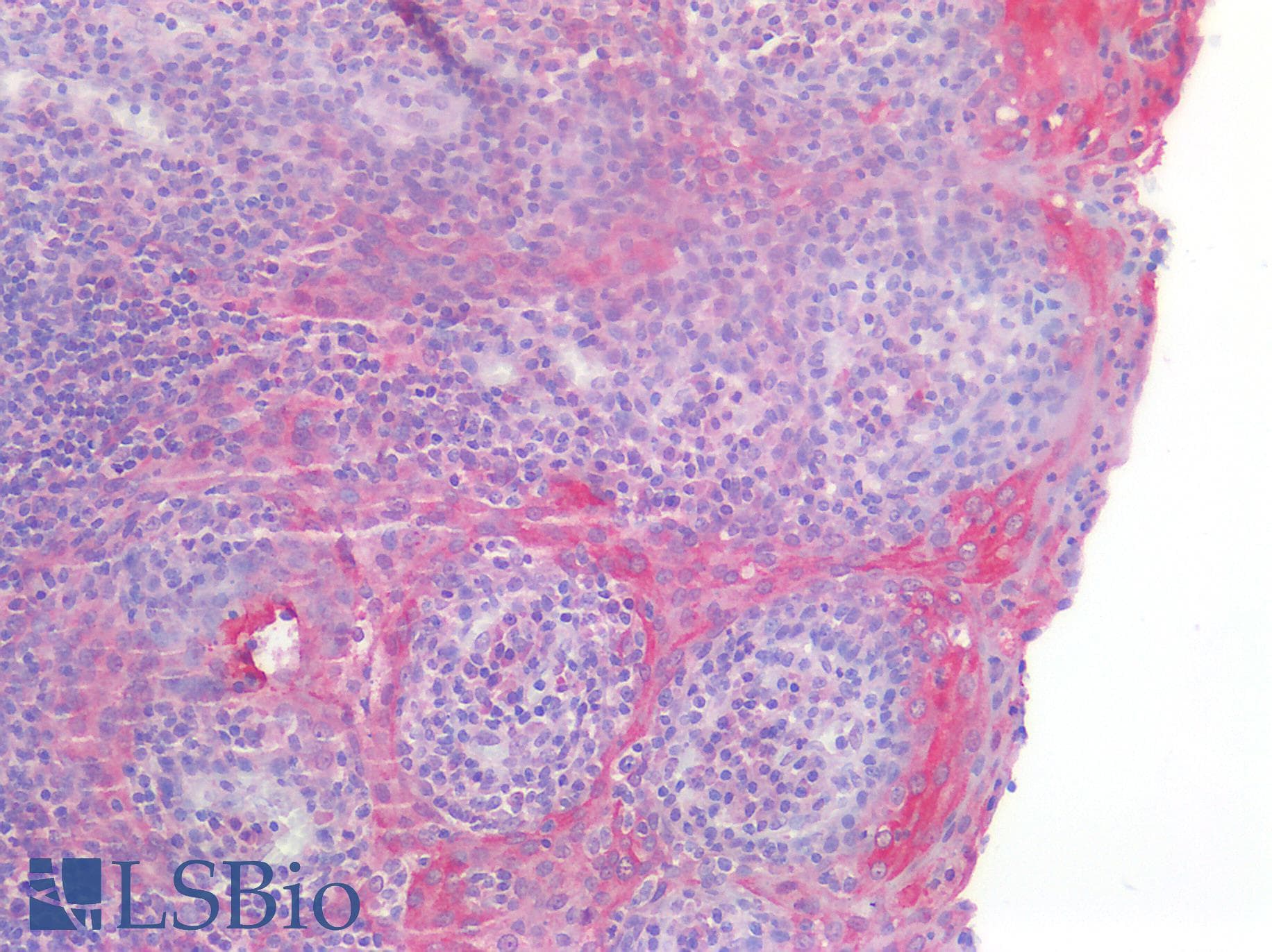 IHC-plus™ Polyclonal Rabbit anti-Human CASP3 / Caspase 3 Antibody (IHC)