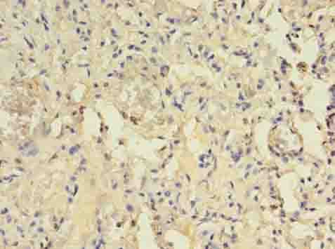 CENTB1 / ACAP1 Antibody