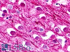 PathPlus™ NPFF2 / NPFFR2 Antibody (N-Terminus)