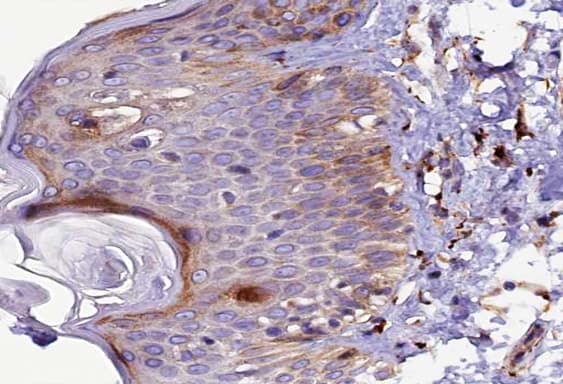 Polyclonal Rabbit anti-Human KDR / VEGFR2 / FLK1 Antibody (phospho-Tyr1214, IHC, IF, WB)