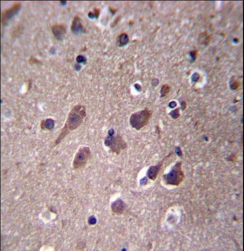 PHACTR3 Antibody (aa17-46)