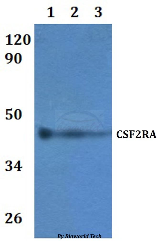 CSF2RA / CD116 Antibody