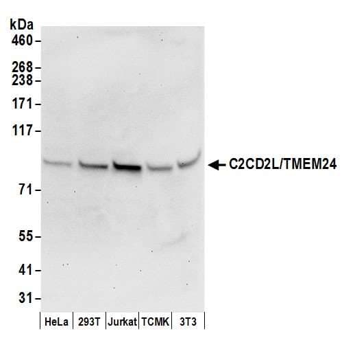 C2CD2L / TMEM24 Antibody (aa656-706)