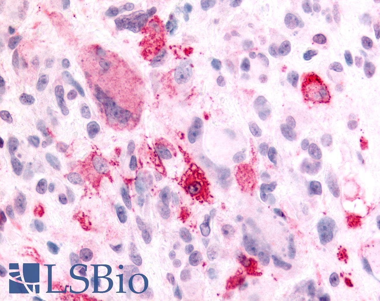 PathPlus™ Polyclonal Rabbit anti-Human NPBWR2 / GPR8 Antibody (Cytoplasmic Domain, IHC)