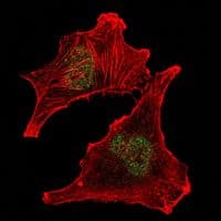 SUZ12 Antibody (clone 2C11)