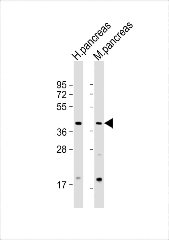 GMPPB Antibody (N-Terminus)